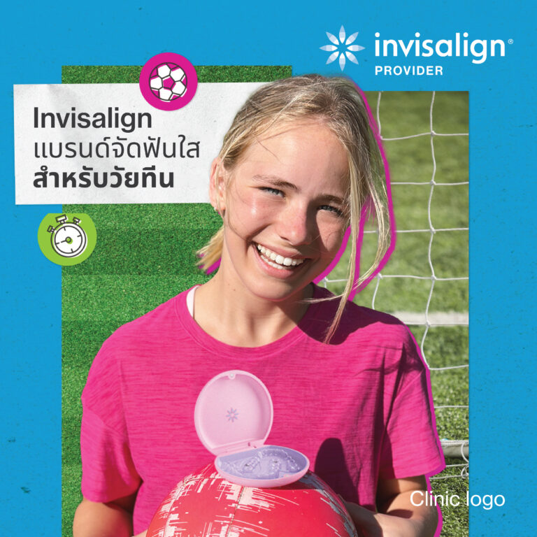 Invisalign แบรนด์จัดฟันใสสำหรับวัยทีน