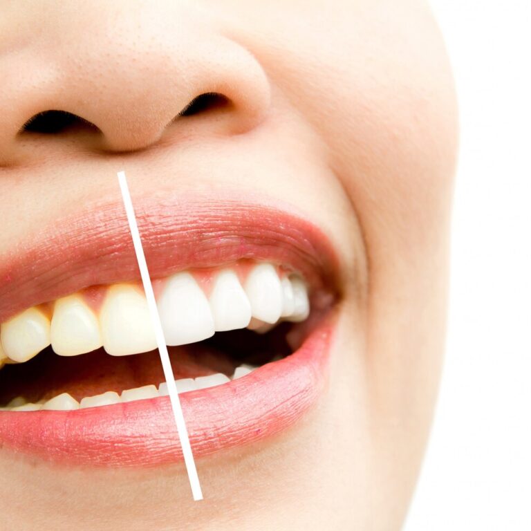woman-whitening-treatment_1232-185